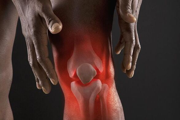 Symptômes de l'arthrose