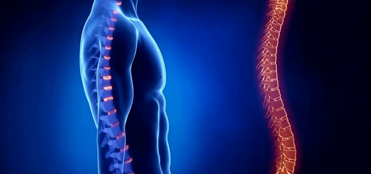 Blessures à la colonne vertébrale dues à l'ostéochondrose.