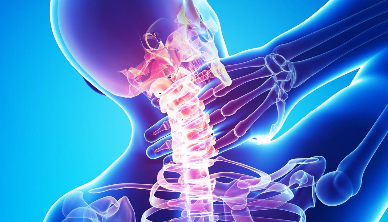 douleur au cou due à l'ostéochondrose