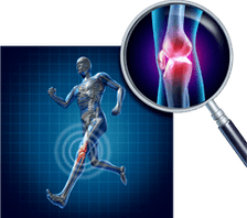 arthrose de l'articulation du genou